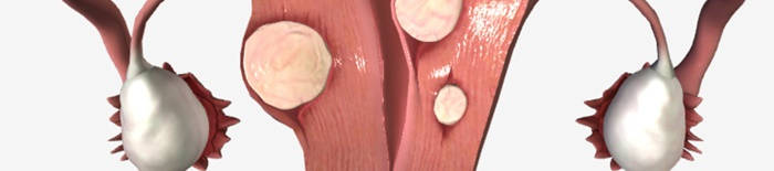 desmesothelialenGewebes1.jpg