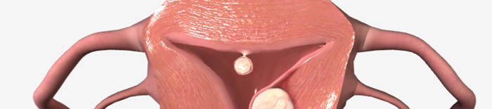 desmesothelialenGewebes1.jpg