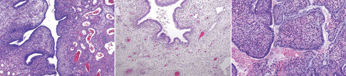 desmesothelialenGewebes1.jpg
