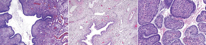 desmesothelialenGewebes1.jpg