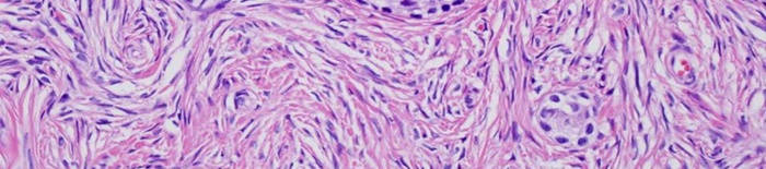 desmesothelialenGewebes1.jpg