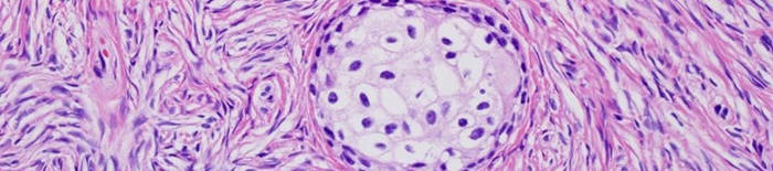desmesothelialenGewebes1.jpg
