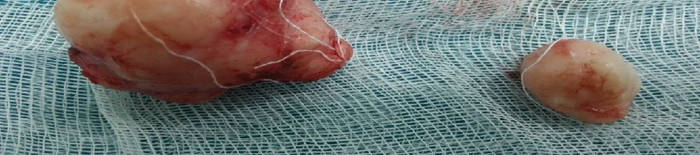 desmesothelialenGewebes1.jpg