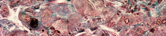 desmesothelialenGewebes1.jpg