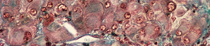 desmesothelialenGewebes1.jpg