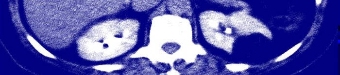 desmesothelialenGewebes1.jpg