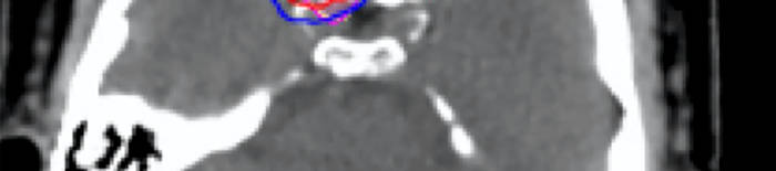 desmesothelialenGewebes1.jpg