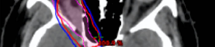 desmesothelialenGewebes1.jpg
