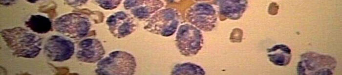 desmesothelialenGewebes1.jpg