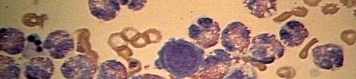 desmesothelialenGewebes1.jpg