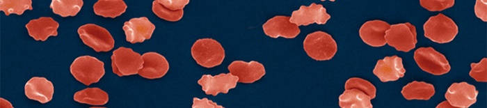 desmesothelialenGewebes1.jpg