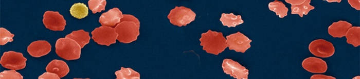 desmesothelialenGewebes1.jpg