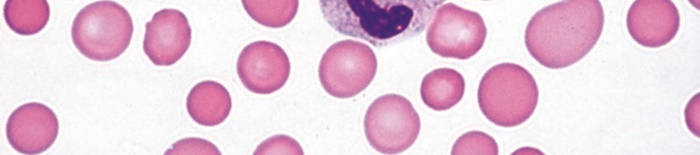 desmesothelialenGewebes1.jpg