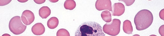 desmesothelialenGewebes1.jpg