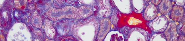 desmesothelialenGewebes1.jpg