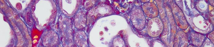 desmesothelialenGewebes1.jpg