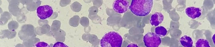 desmesothelialenGewebes1.jpg