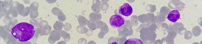 desmesothelialenGewebes1.jpg