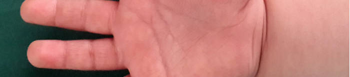 desmesothelialenGewebes1.jpg