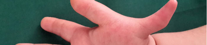 desmesothelialenGewebes1.jpg