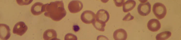 desmesothelialenGewebes1.jpg