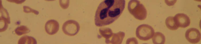 desmesothelialenGewebes1.jpg