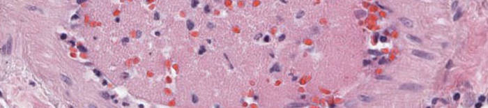desmesothelialenGewebes1.jpg