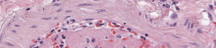 desmesothelialenGewebes1.jpg