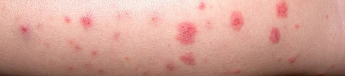 desmesothelialenGewebes1.jpg