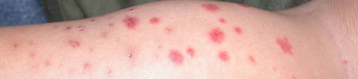desmesothelialenGewebes1.jpg