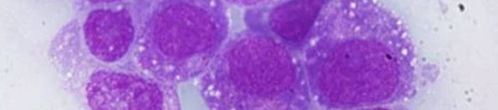 desmesothelialenGewebes1.jpg