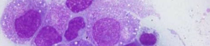 desmesothelialenGewebes1.jpg