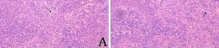 desmesothelialenGewebes1.jpg