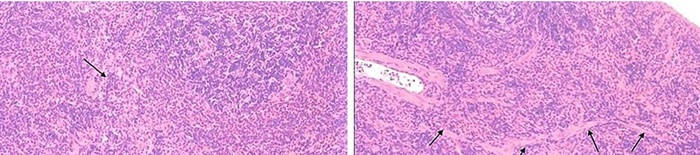 desmesothelialenGewebes1.jpg