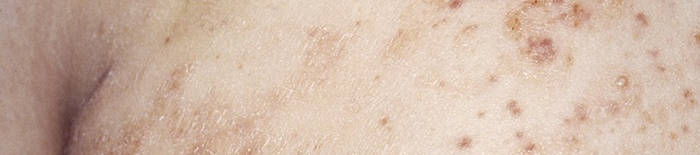 desmesothelialenGewebes1.jpg