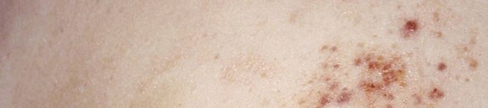 desmesothelialenGewebes1.jpg