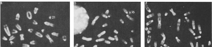 desmesothelialenGewebes1.jpg