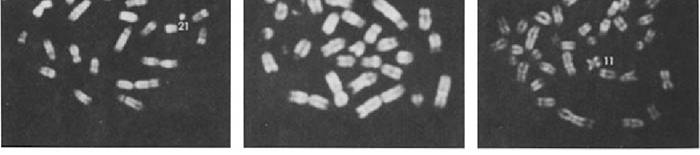 desmesothelialenGewebes1.jpg