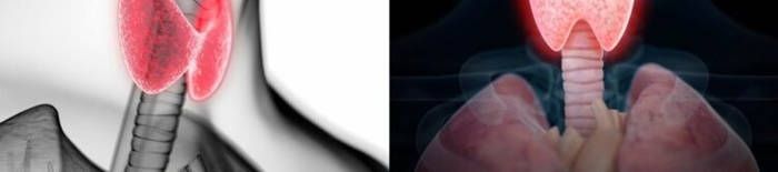 Colitis-ulcerosa1.jpg