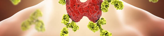 Colitis-ulcerosa1.jpg