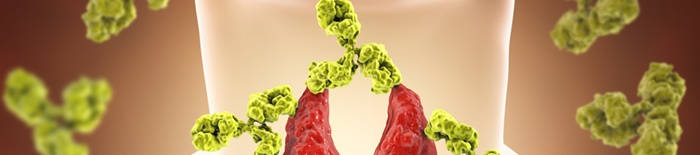 Colitis-ulcerosa1.jpg