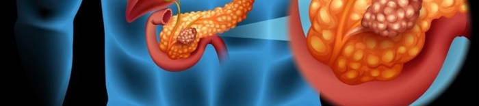 Colitis-ulcerosa1.jpg