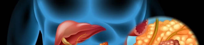 Colitis-ulcerosa1.jpg