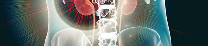 Colitis-ulcerosa1.jpg