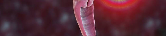 Colitis-ulcerosa1.jpg