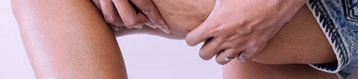 Colitis-ulcerosa1.jpg