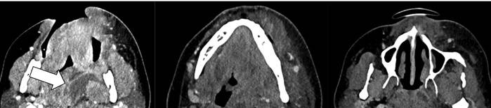 Hereditaere_Ataxie1.jpg