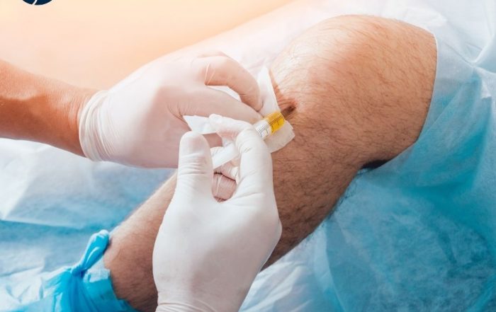 PRP Injection in Hawaii | Dr. Paul Norio Morton by paulnoriomorton on ...