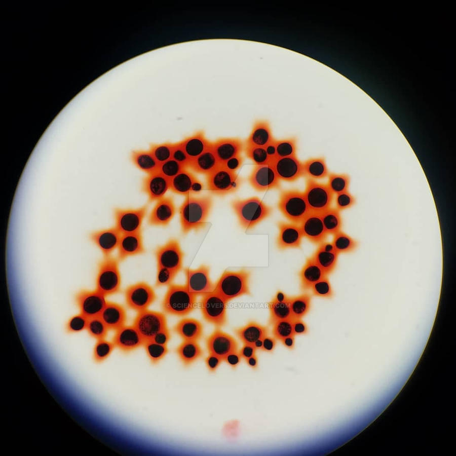 Cryptococcus yeast by Sciencelover5 on DeviantArt