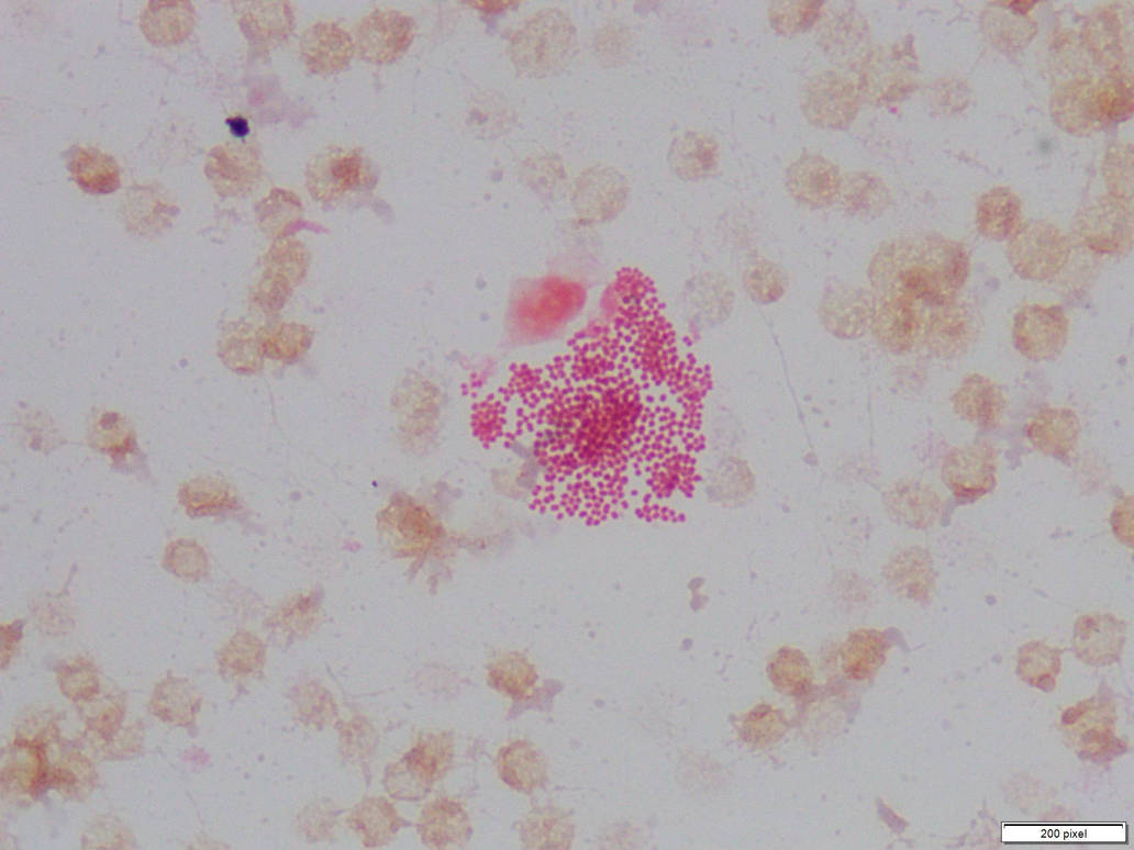 Neisseria sicca by Sciencelover5 on DeviantArt